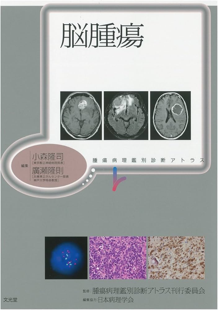脳腫瘍 (腫瘍病理鑑別診断アトラス) | 小森 隆司, 廣瀬 隆則 |本
