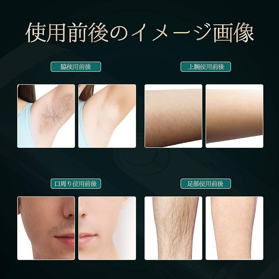 Amazon | Omuse IPL光脱毛器 国内サロン級 光美容器 だつもうき脱毛器