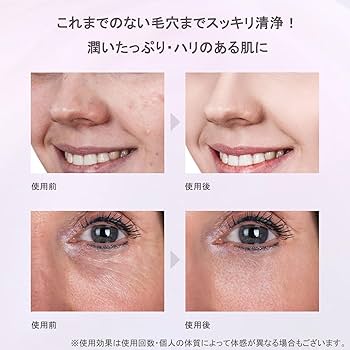 Amazon.co.jp: Facial Equipment COSBEAUTY Aquarial Peeling Pro EX