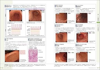 病気がみえる vol.1 消化器 第6版 | 医療情報科学研究所 |本 | 通販