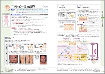 病気がみえる vol.14 皮膚科 第1版 | 医療情報科学研究所 |本 | 通販