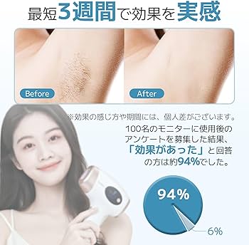 Saris 脱毛器 充電器 メガネ付き Saris 脱毛器 充電器 メガネ付き Amazon |