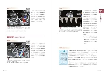 改訂2版 新生児の心エコー入門:超音波検査にもとづくNICU循環管理の
