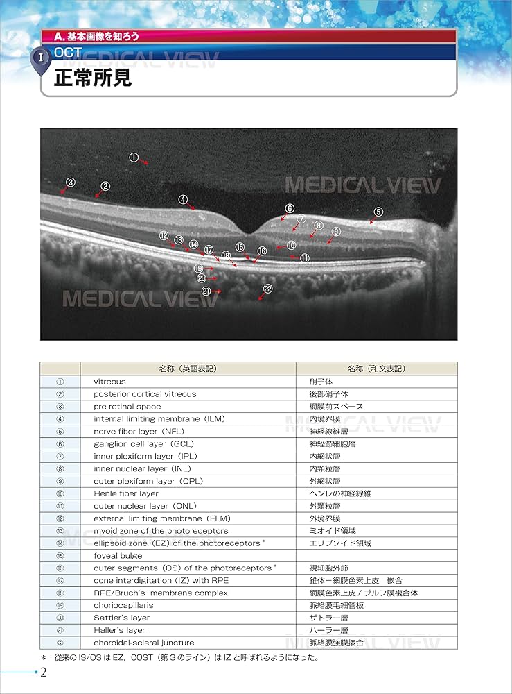 新OCT・OCTA読影トレーニング | 白神 史雄, 飯田 知弘 |本 | 通販 | Amazon