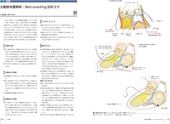 心臓血管外科手術基本手技 (心臓血管外科手術エクセレンス) | 坂東 興