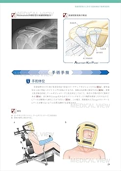 上肢の関節鏡視下手術［Web動画付］ (新OS NEXUS No.12) | 今井 晋二