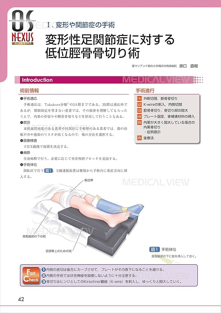 足・足関節の最新の手術 (OS NEXUS(電子版付き) 19) | 中村 茂 |本