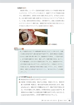 眼科レジデントのためのベーシック手術 ─ 電子版付 ─ | 谷戸正樹 |本