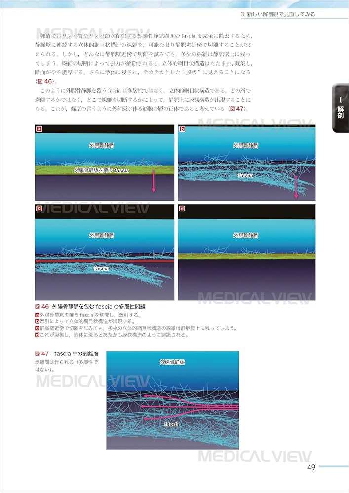 Amazon.co.jp: 根治のための前立腺全摘術の新しい考え方−最新の