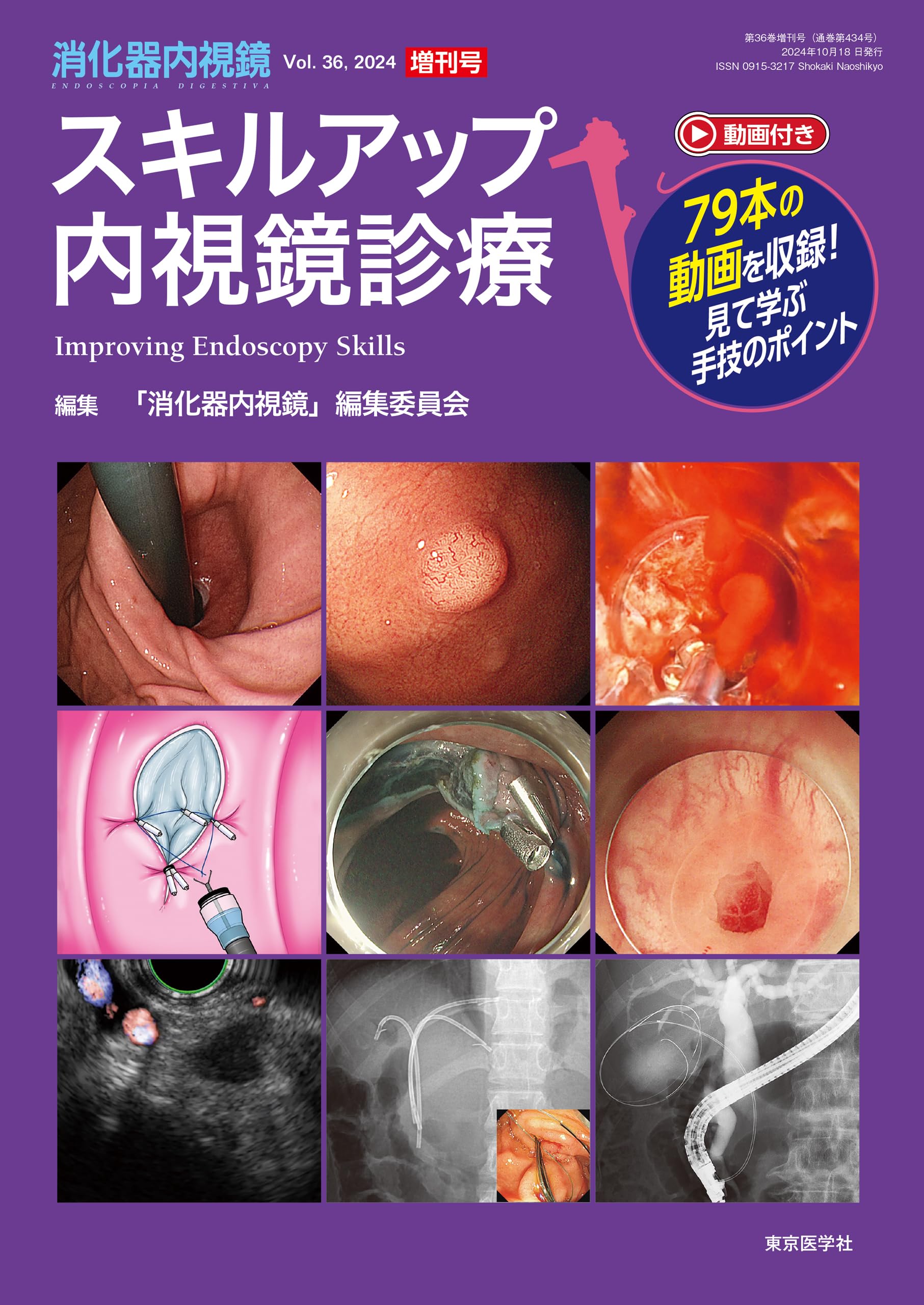 消化器内視鏡36巻増刊号2024年増刊号 スキルアップ内視鏡診療 | 「消化