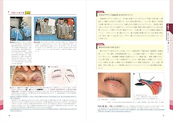 美容外科医になったら最初に読む 美容手術の基本： 安全で患者満足度の