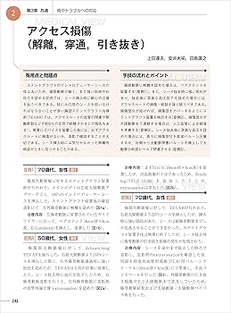 ステントグラフトの大技・小技−胸腹部大動脈瘤へのワンランクアップの