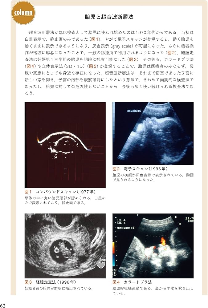 周産期マニュアル: 胎児疾患の診断から管理まで | 佐村 修, 宗田 聡