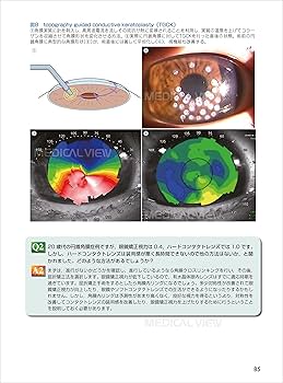 診断と治療 (眼科診療マイスター II) | 飯田 知弘, 中澤 徹, 堀 裕一