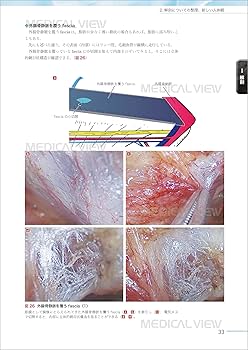 81Ci3PI2PGL._AC_UF350,