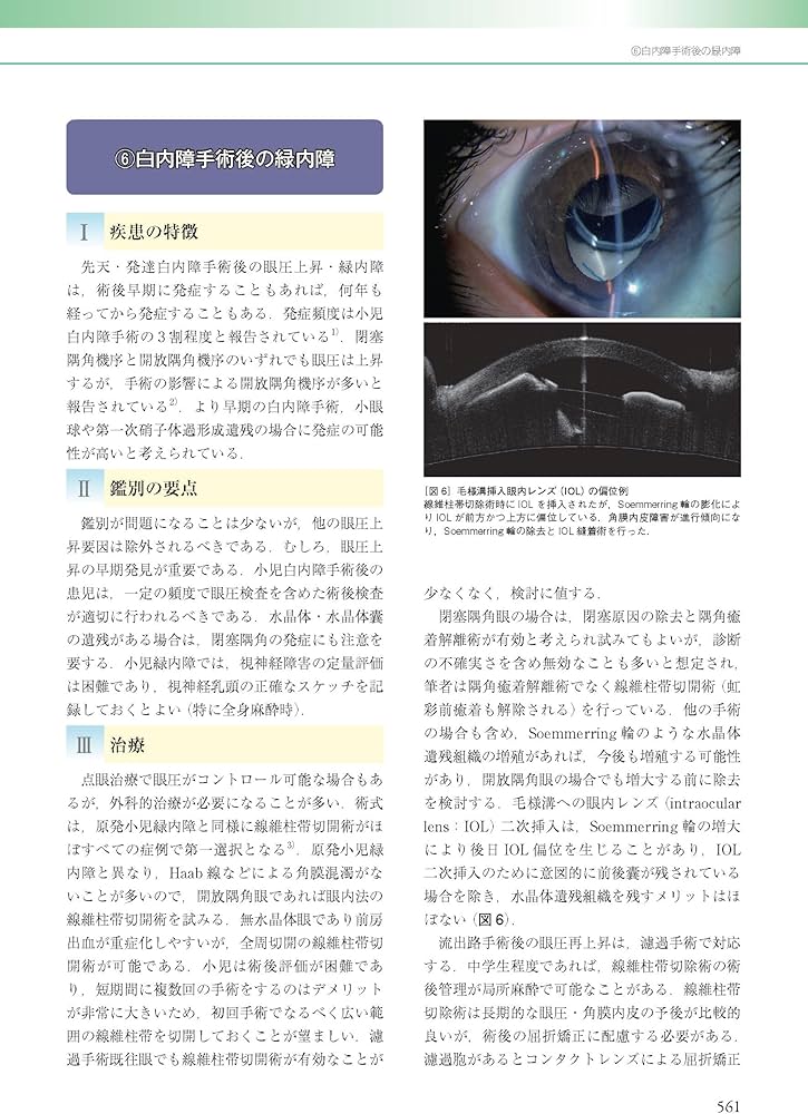 眼科診療ガイド 第2版 | 根木 昭 |本 | 通販 | Amazon