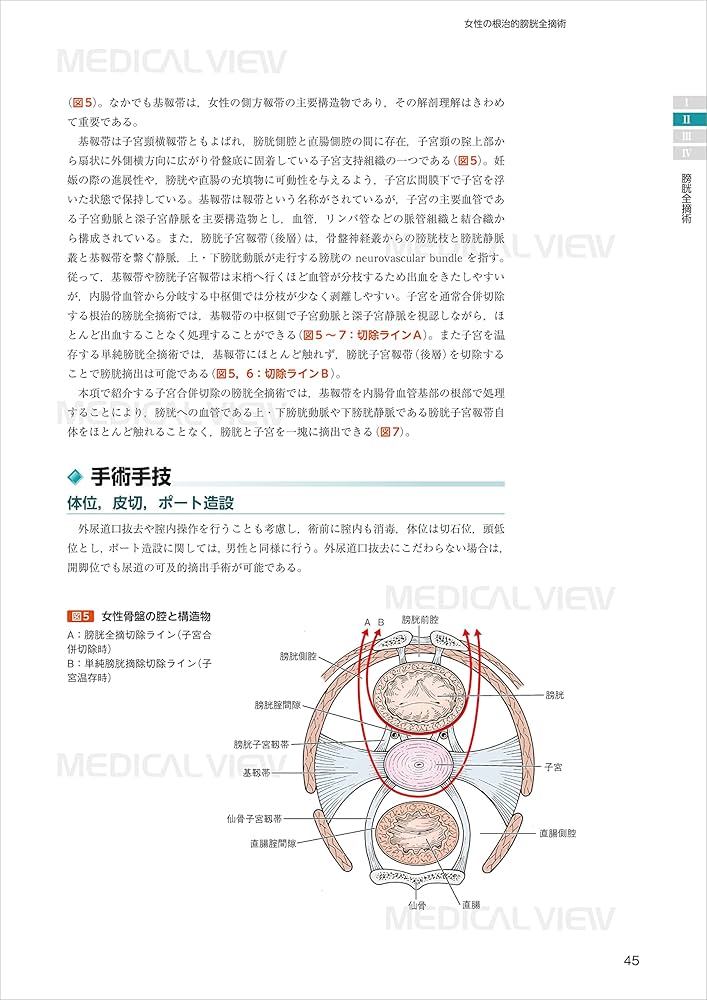 究める鏡視下膀胱全摘術・尿路変向術 Level up LRC, RARC | 三木 淳