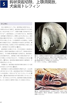 Amazon.co.jp: ウォーモルド内視鏡下鼻副鼻腔・頭蓋底手術 : 本間 明宏: 本