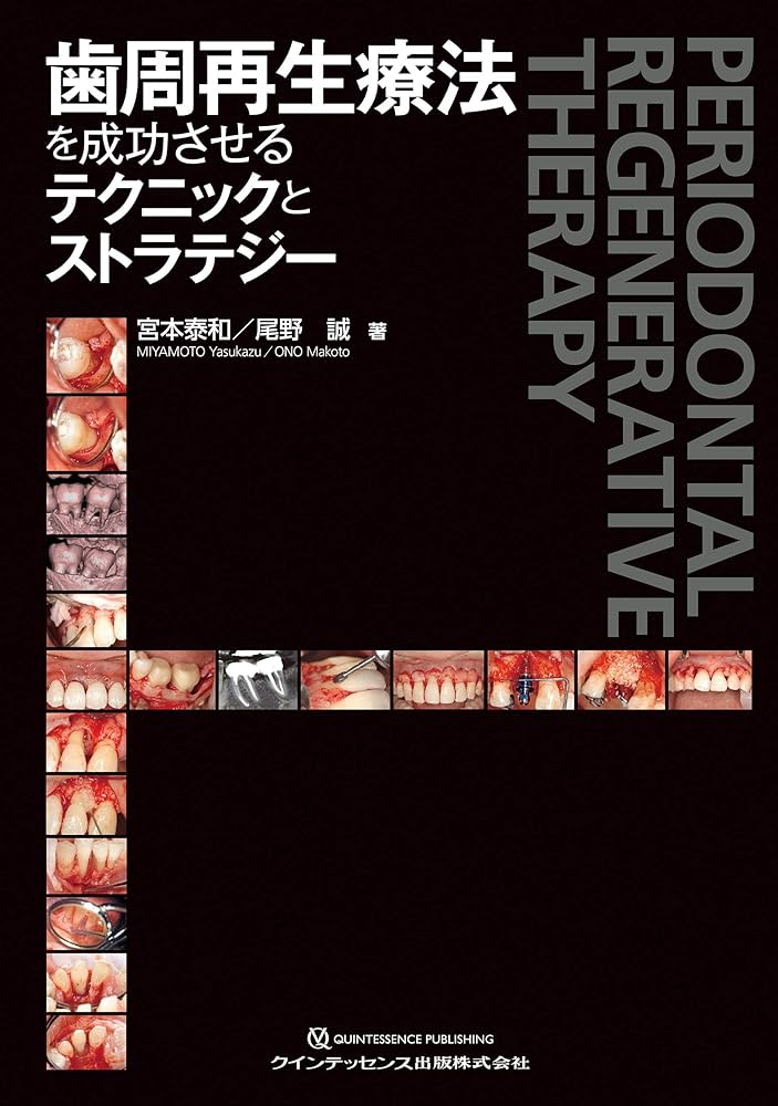 歯周再生療法を成功させるテクニックとストラテジー | 宮本 泰和, 尾野
