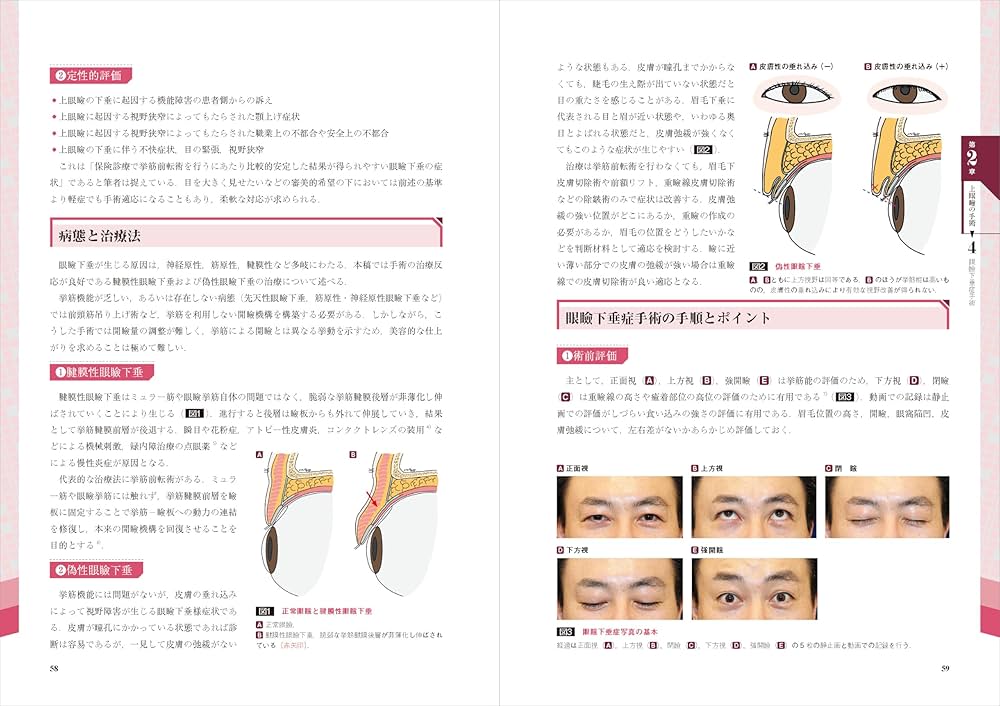 美容外科医になったら最初に読む 美容手術の基本： 安全で患者満足度の