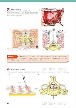 最小侵襲脊椎外科［Web動画付］ (新OS NEXUS No.11) | 佐藤 公治 |本