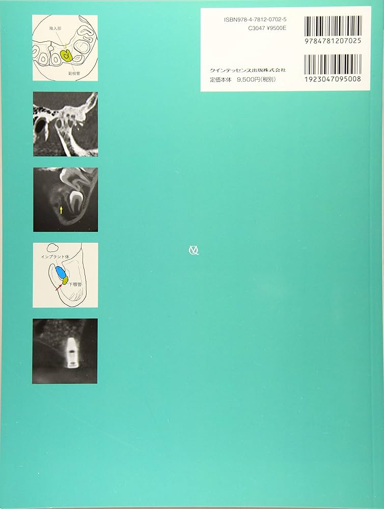 決定版 実践マニュアル 歯科用CTの見かた・読みかた | 森本 泰宏, 金田