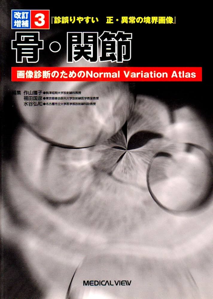 診誤りやすい正・異常の境界画像―画像診断のためのNormal Variation