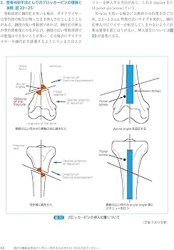 骨折治療基本手技アトラス~押さえておきたい10のプロジェクト | 最上