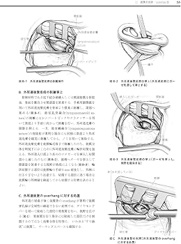 耳鼻咽喉・頭頸部手術アトラス[上巻] 第2版 | 森山 寛 |本 | 通販 | Amazon