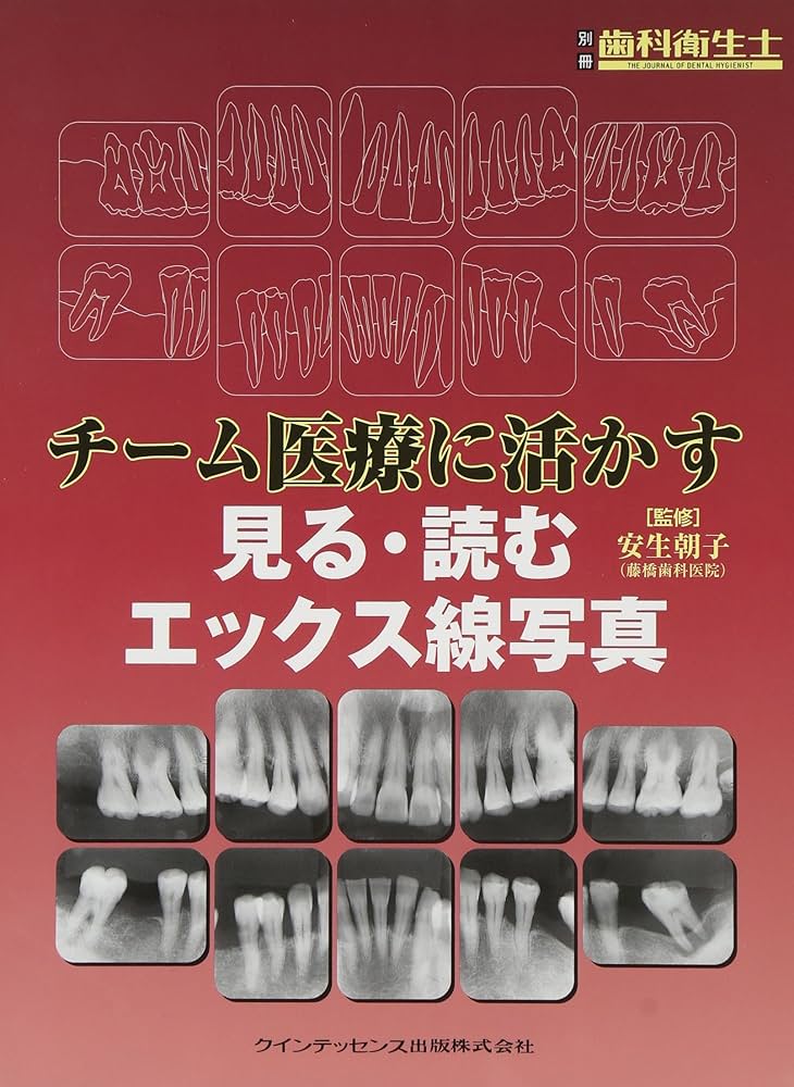 チーム医療に活かす見る・読むエックス線写真 (別冊歯科衛生士) |本