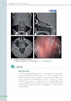 81e4g3OL76L._AC_UF350,