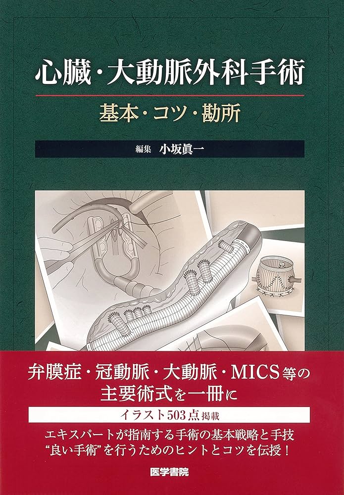 心臓・大動脈外科手術: 基本・コツ・勘所 | 小坂 眞一 |本 | 通販 | Amazon