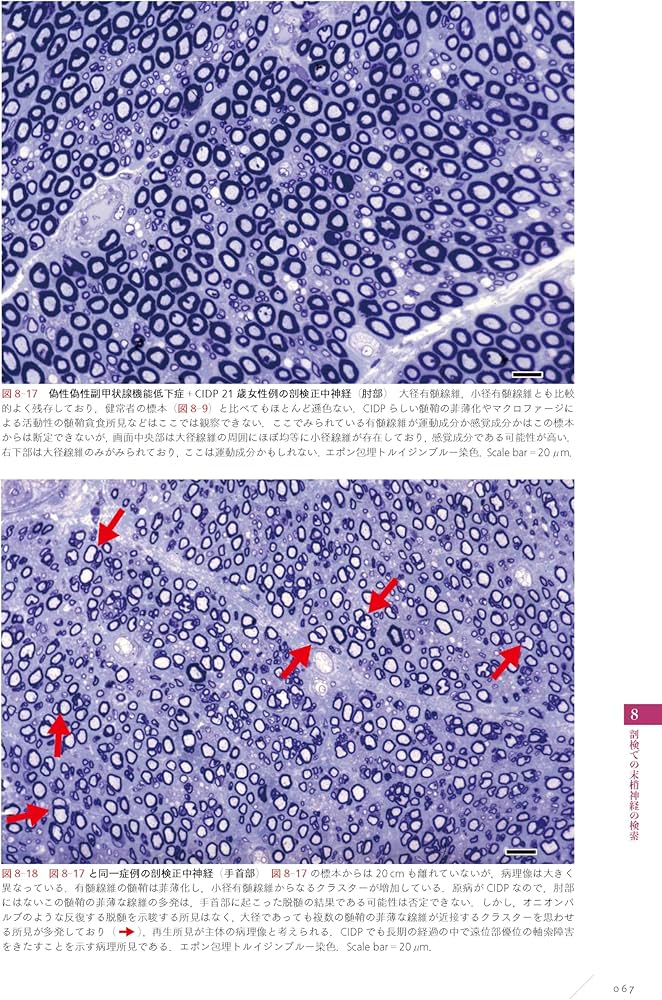末梢神経病理：どう作り、どう読み、どう臨床に生かすか | 神田隆
