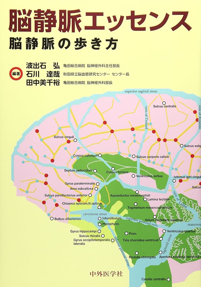 Amazon.co.jp: 脳静脈エッセンス: 脳静脈の歩き方 : 波出石弘, 石川