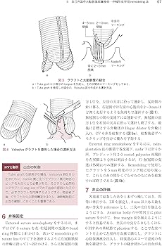 心臓・大動脈外科手術: 基本・コツ・勘所 | 小坂 眞一 |本 | 通販 | Amazon
