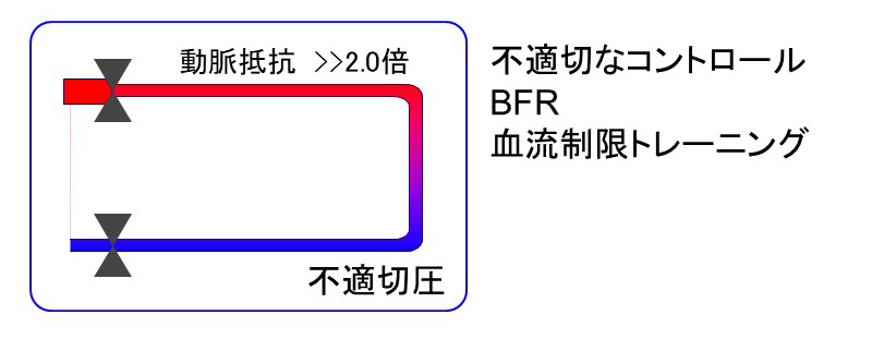 医師解説：【血流の】“ニセ”加圧トレーニングにご用心【適切な
