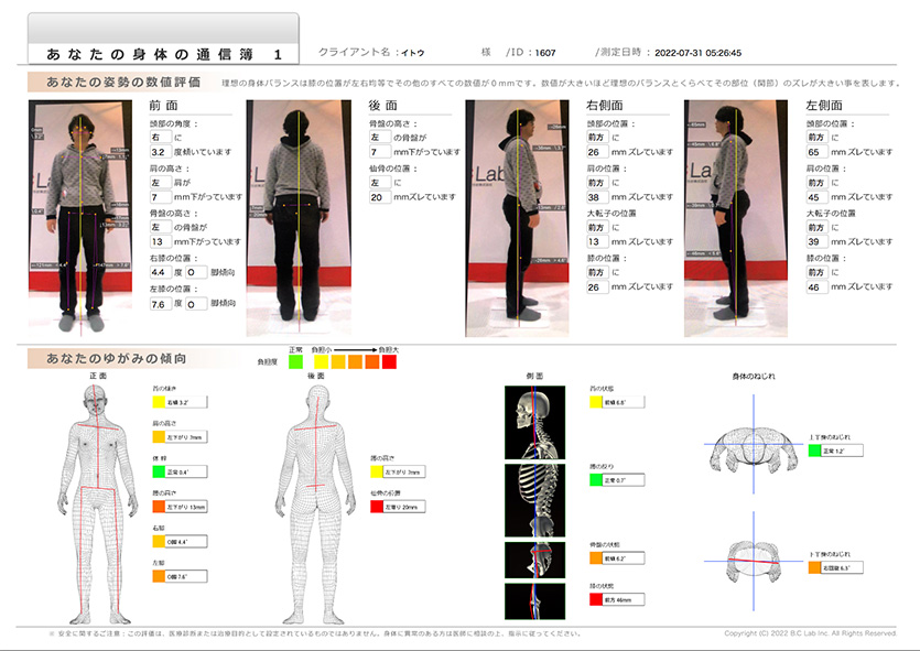 教えて先生！】姿勢分析器から何がわかるの？ - 未来整体メディア