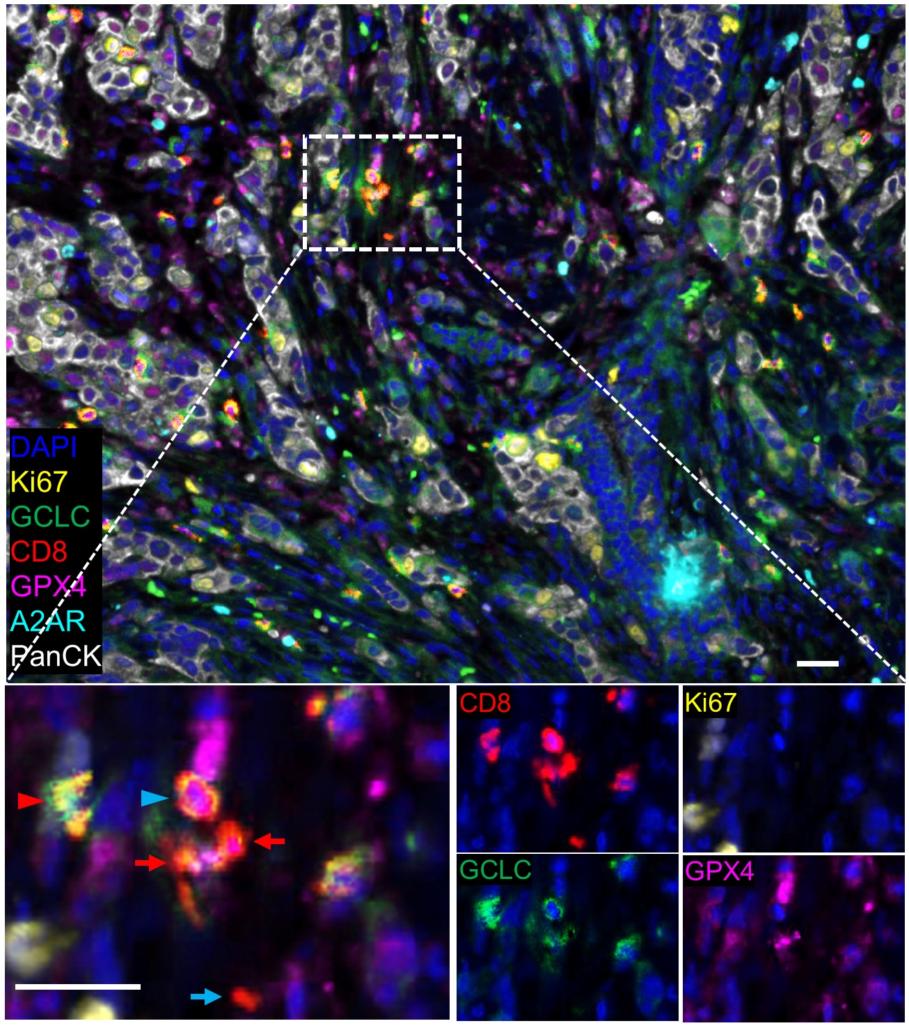 Novel Mechanism Supports Antitumor Response and T-cell Survival