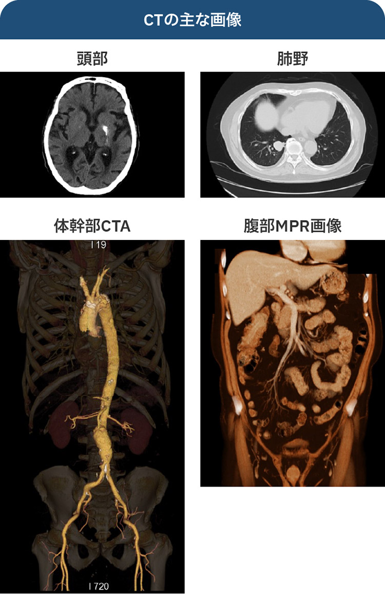放射線課 | 診療技術部 | 診療科・部門紹介 | 一般財団法人 芙蓉協会
