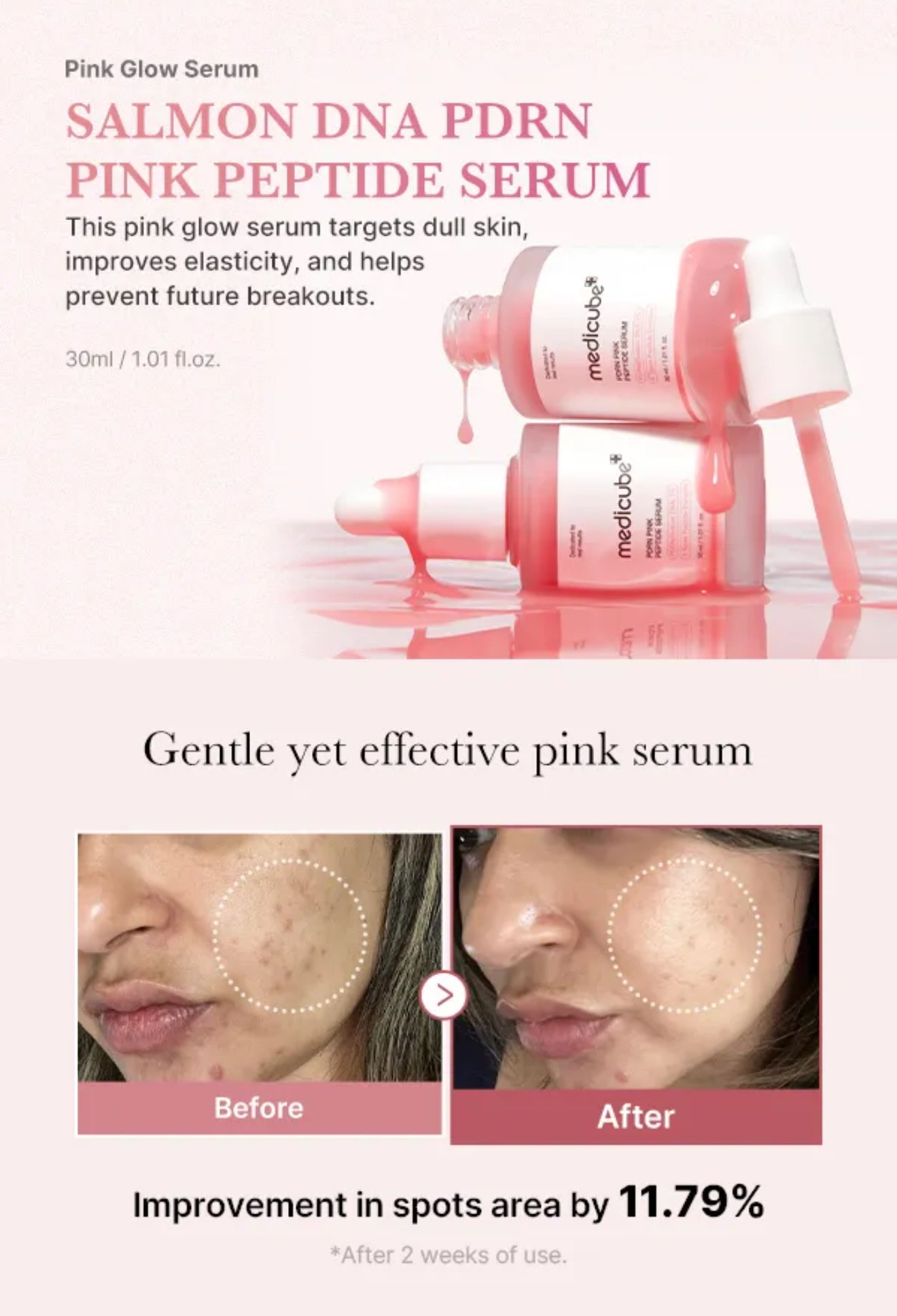 Medicube Pro 360美顔器とPDRN PINK SERUMのセット 楽天市場