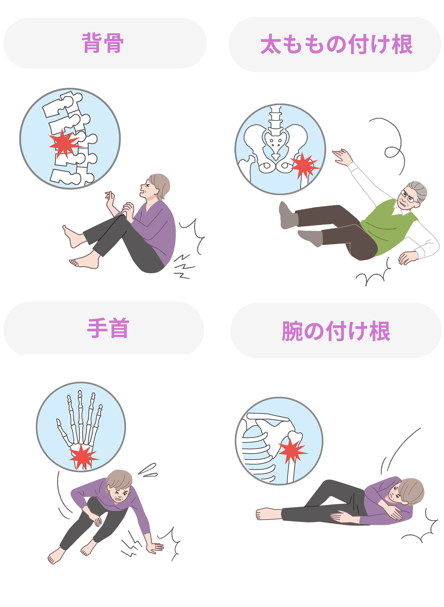 症状と注意すること | 骨粗しょう症って？ | オスタバロナビ ～治療を