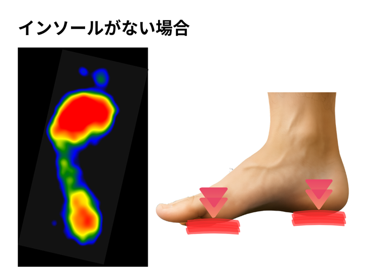 オーダーメイドインソール サワムラヤ靴店＜公式＞