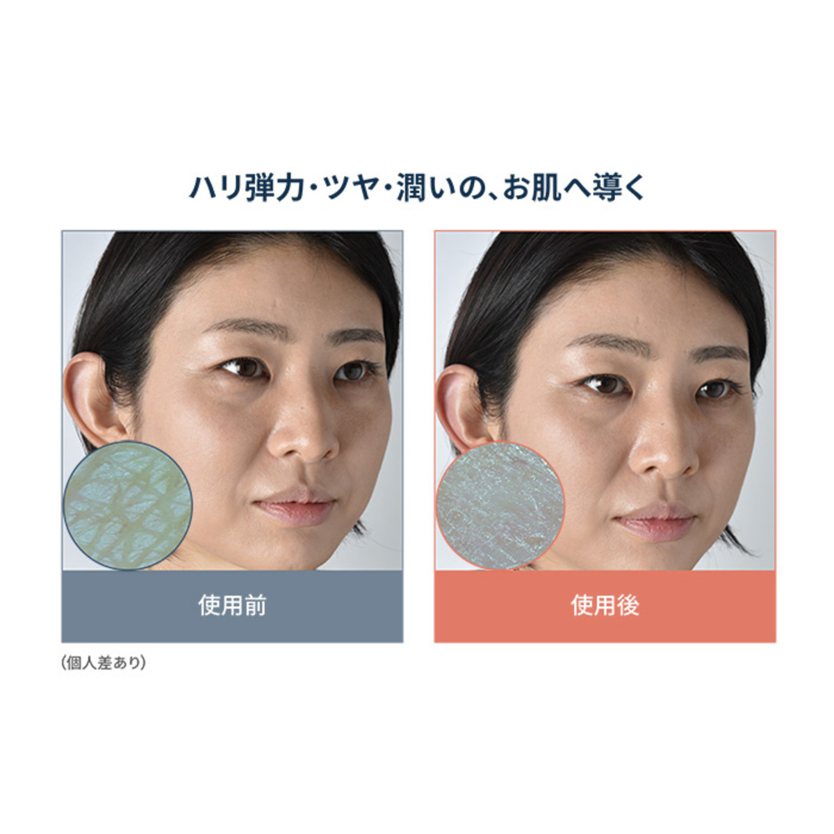 リマドス ビューティーモイストクリーム50g 2本セット リマドス