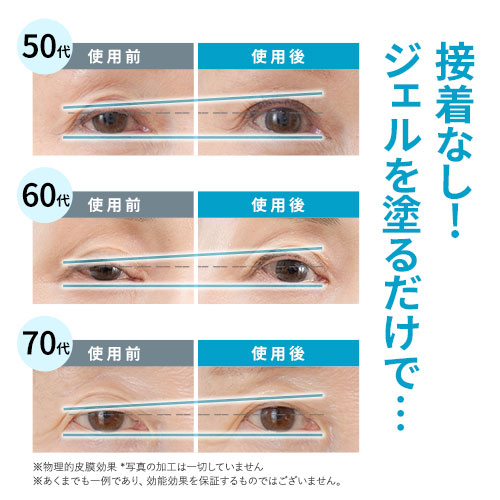 北の快適工房 【爆買WEEKセール!】公式 リッドキララ 2個セット まぶた