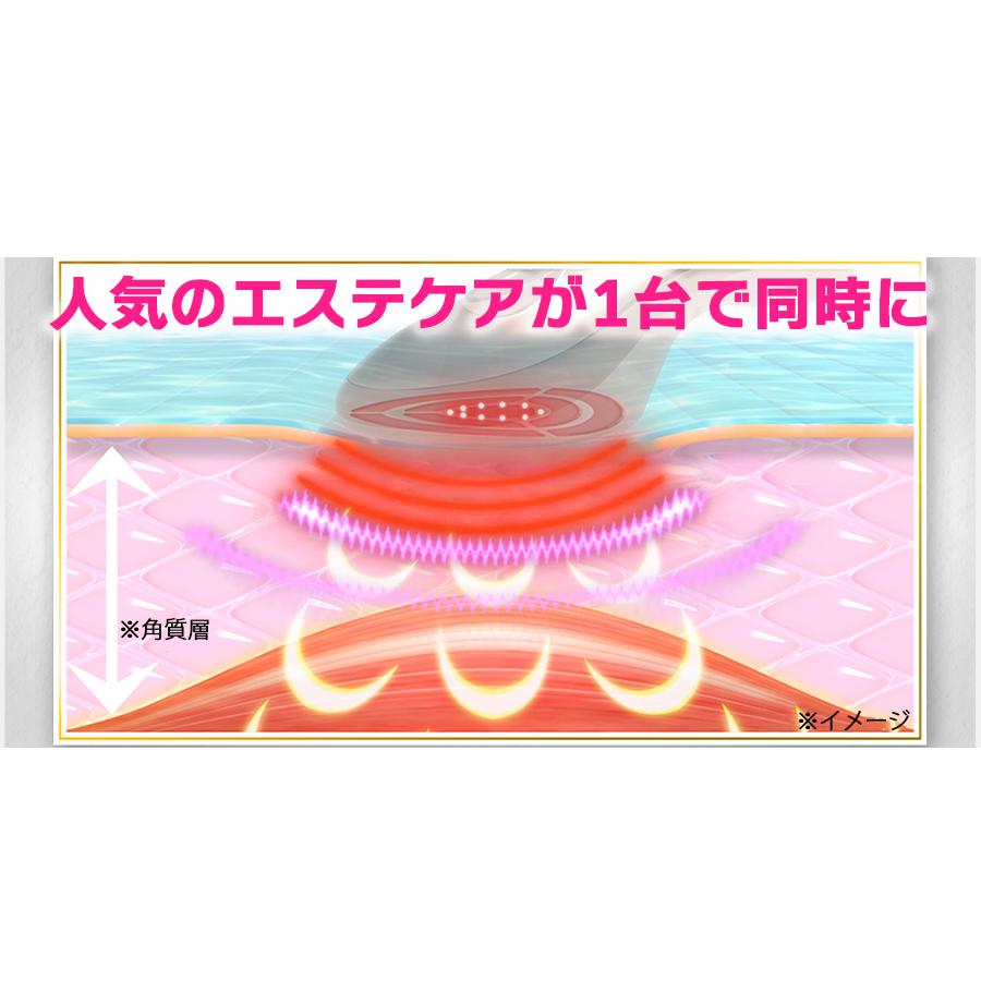 IKKO プロデュース ME ラボン エクラ / エステ EMS ラジオ波 潤い LED