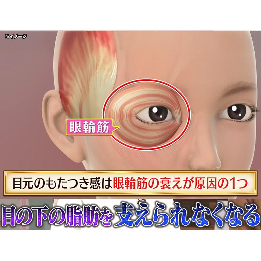 CREAGE（クリアージュ） アイリフト Neo / ヤーマン CR12V 【TBS