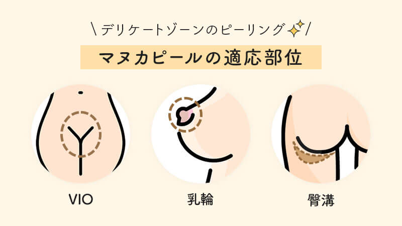 デリケートゾーンのピーリング｜新宿駅前婦人科クリニック｜黒ずみケア