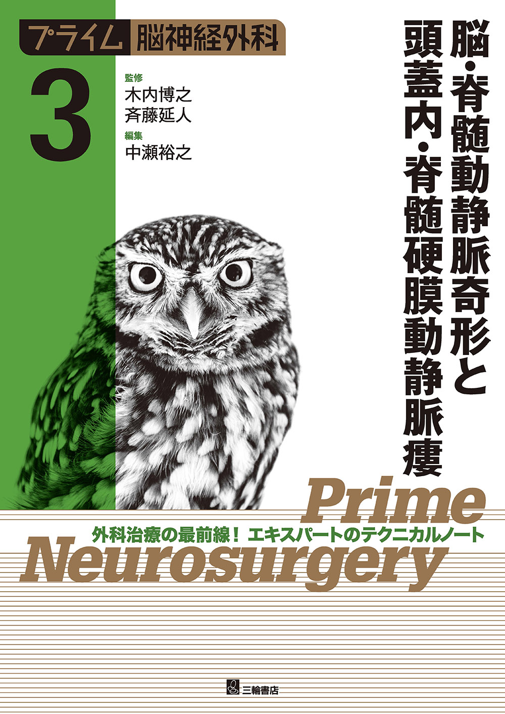 プライム脳神経外科3 脳・脊髄動静脈奇形と頭蓋内・脊髄硬膜動静脈瘻