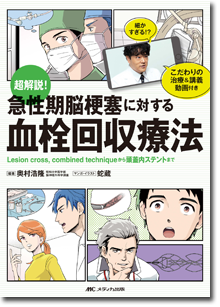 超解説！ 急性期脳梗塞に対する血栓回収療法 | オンラインストア｜看護