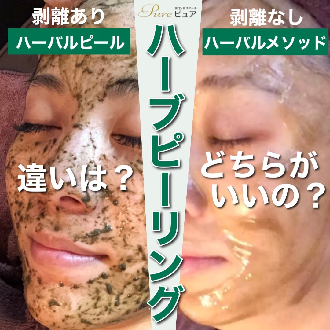 剥離あり 剥離なし 違い | ハーバルピールブログ